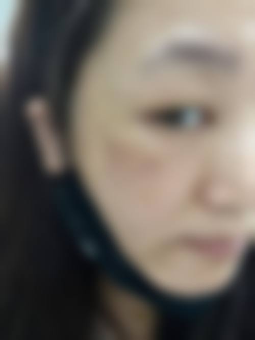 韩国思亲肤乐皮肤医院口碑评价