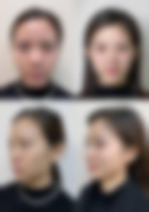 广州香凝整形医院口碑评价如何？