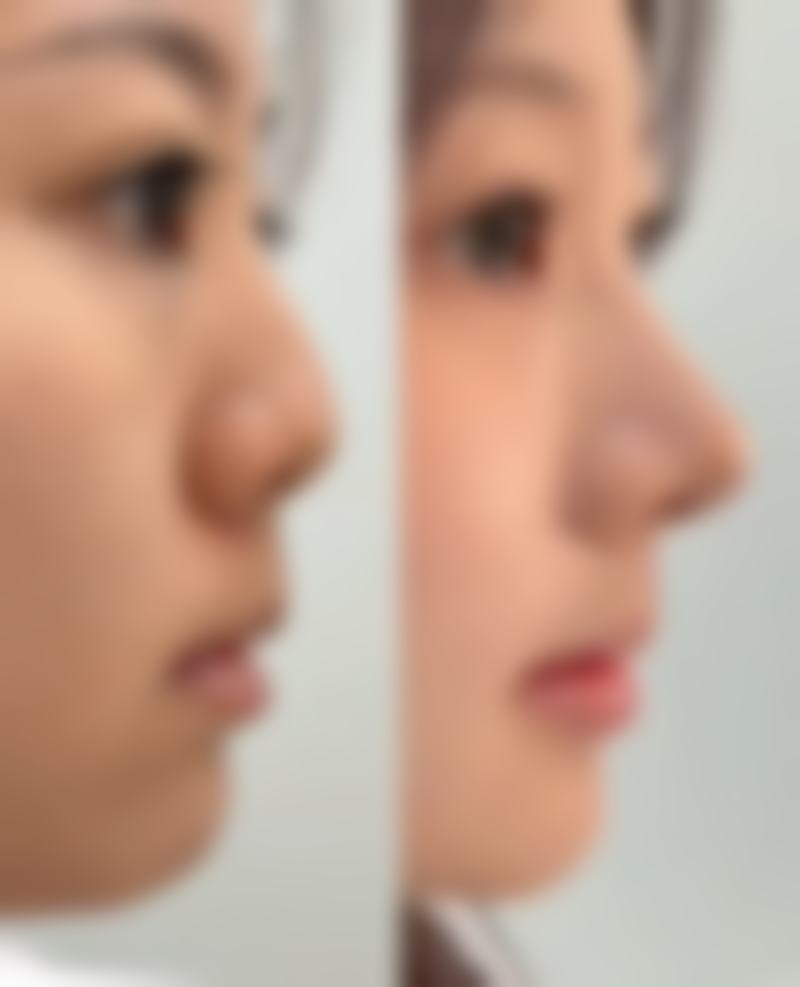 福州比华利医疗美容整形医院医生简介：专精医生团队的实力保护