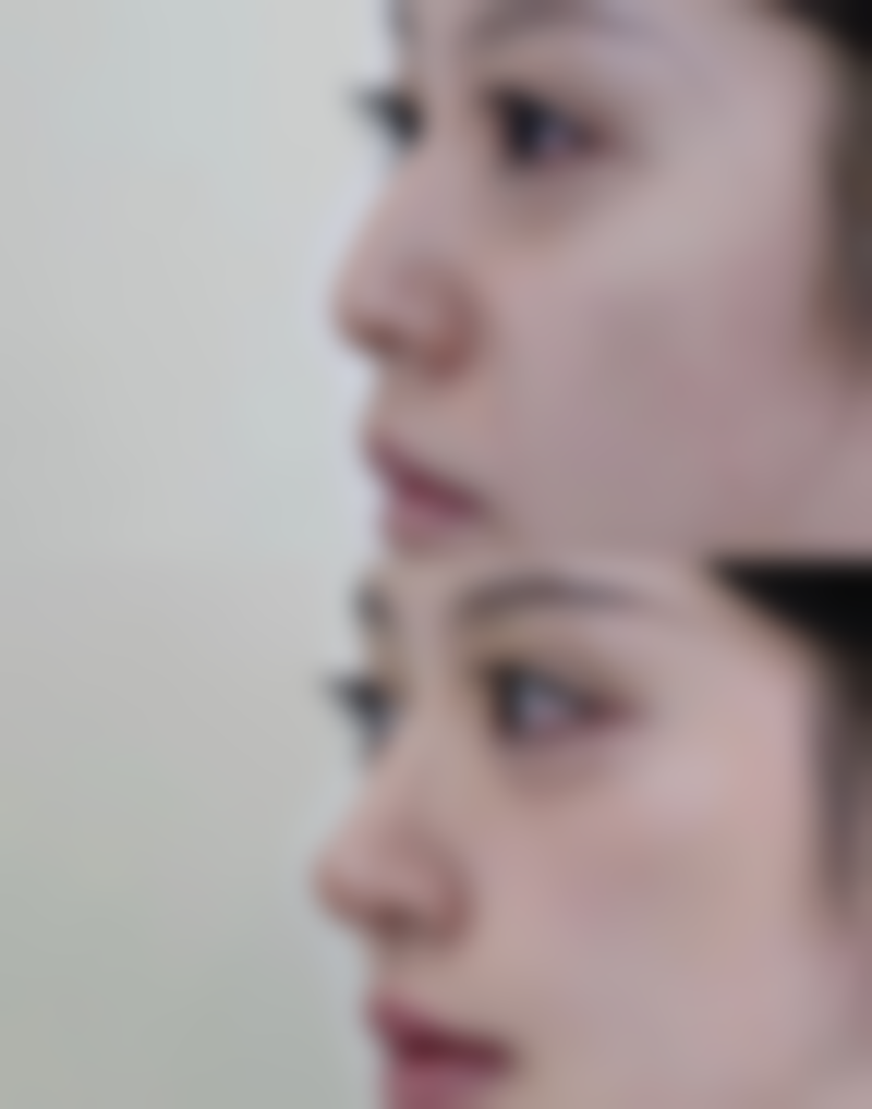 广州香凝整形医院价格表