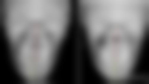 上海宏康医院传授皮肤有疤痕增生怎么护理：记住“三不”原则