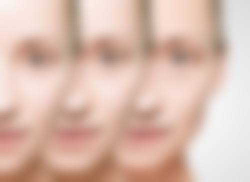 影响隆鼻成效维持时间的三大核心因素