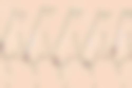 杭州悦可医疗美容诊所收费价格表——杭州雍禾植发医院聚焦