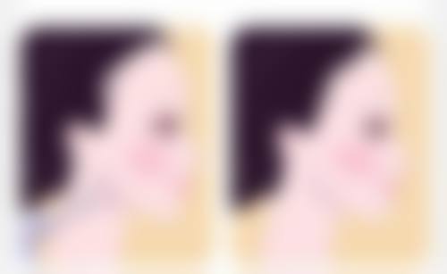 私立医院隆胸手术时间要多久？医院个性化服务的时间考量