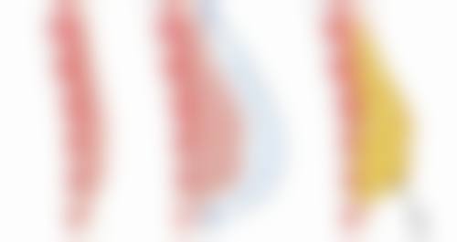 陈倩倩医生做手术价格