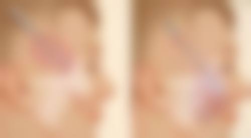 烫伤疤痕十几年了可以修复吗？激光+中医双管齐下，权威医生教你科学淡化