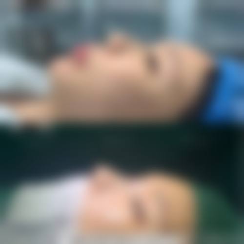 杭州悦可医疗美容诊所邹霞是渠道医生吗——杭州悦可医疗美容诊所技术优势