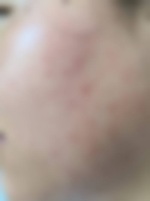 永康东方医疗美容诊所可靠吗