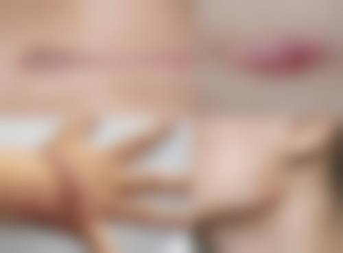 张秀杰医生项目优势