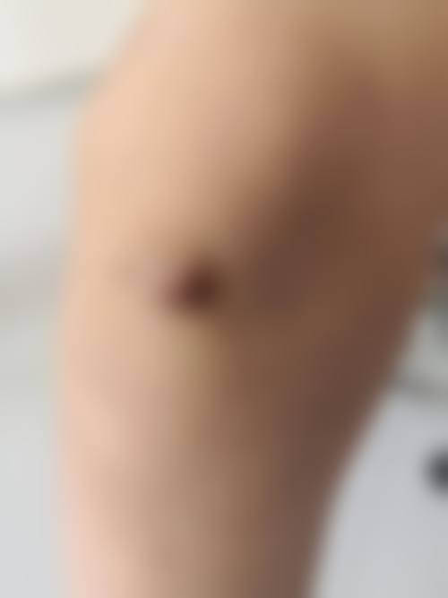 杭州悦可医疗美容诊所高寿松是值得托付的整形骨干医生