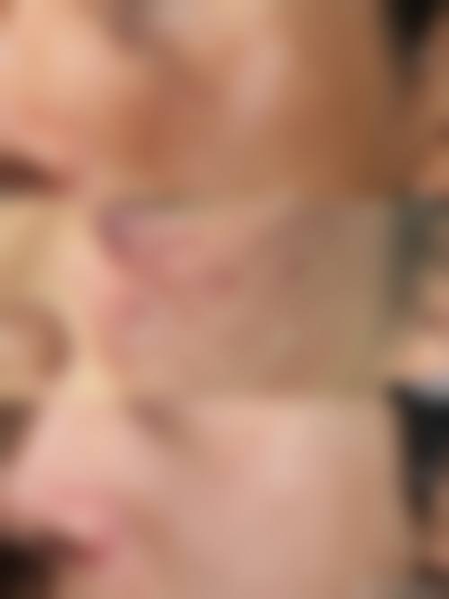 七、普宁名媛医疗美容门诊部怎么样，顾客实例反馈如何