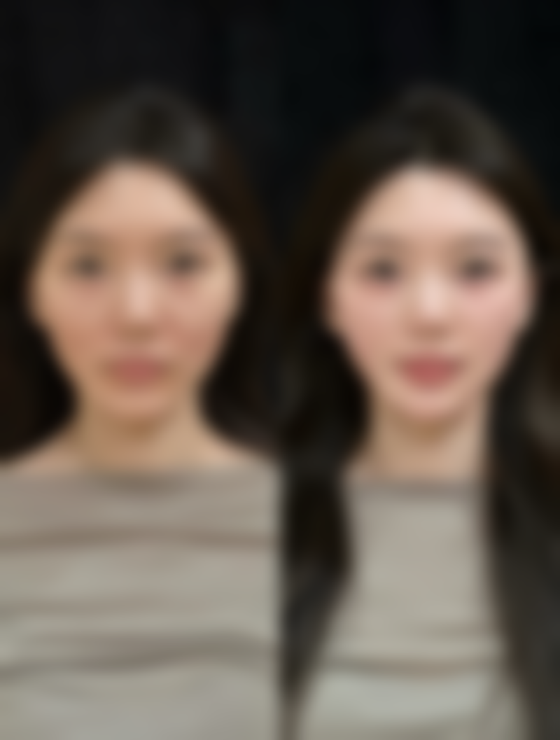 钟剑锋医生怎么挂号