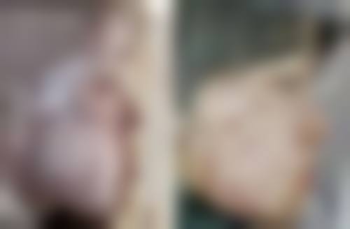 钟剑锋医生怎么挂号