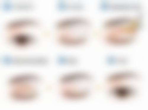 运动减肥对割双眼皮友好程度如何