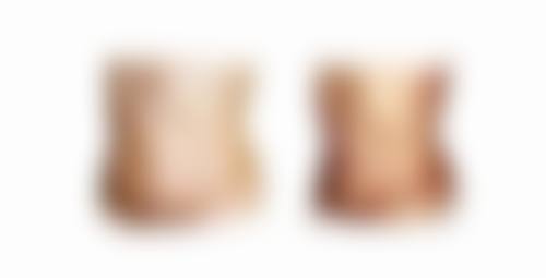 医院强调术后护理：让成效更持久