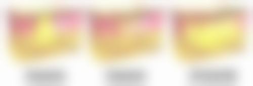 用牙签偶尔划出双眼皮需坚持多久