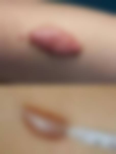 武汉馨媛里整形医院口碑好不好？附真实患者口碑评价