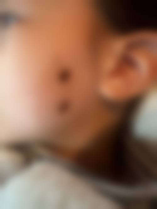 杭州悦可医疗美容诊所熊员平项目的风险提示