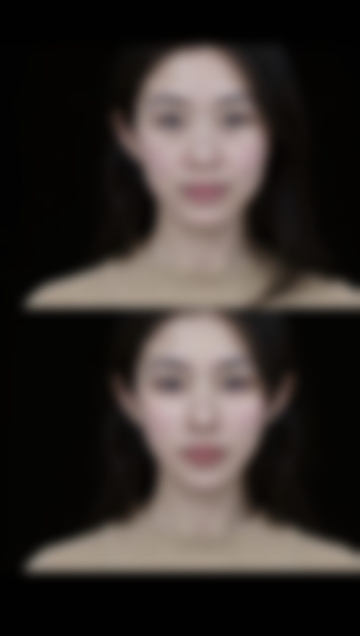 快速祛疤方案：适合“急性子”的紧急战术