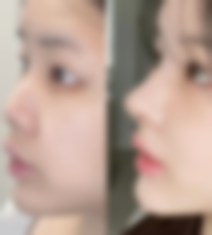 武汉馨媛里整形医院项目特色