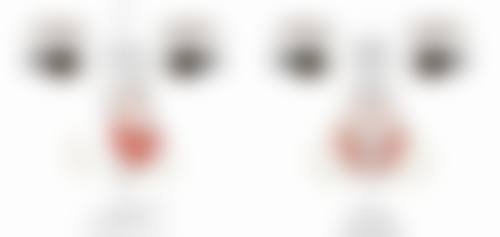 抽脂去眼袋好不好——反弹篇