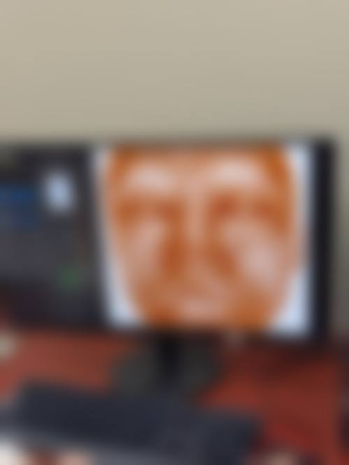 成都华颜整形医院真实患者口碑评价