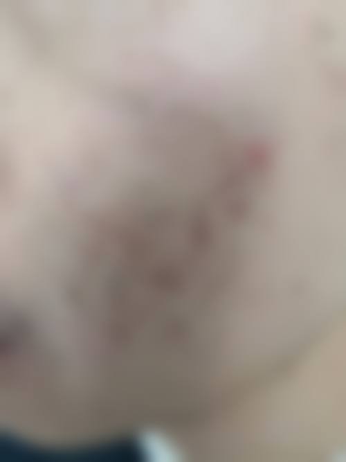 长春京典医疗美容门诊抖音团购活动及价格表