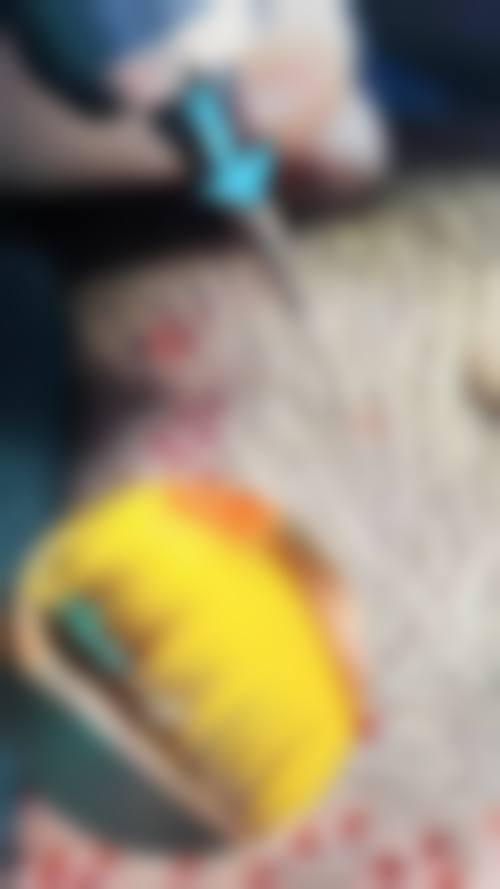 太原美之妍整形美容诊所怎么样，更擅长什么