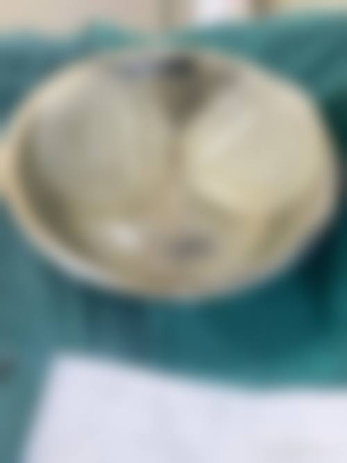 济南美莱整形怎么样：口碑情况