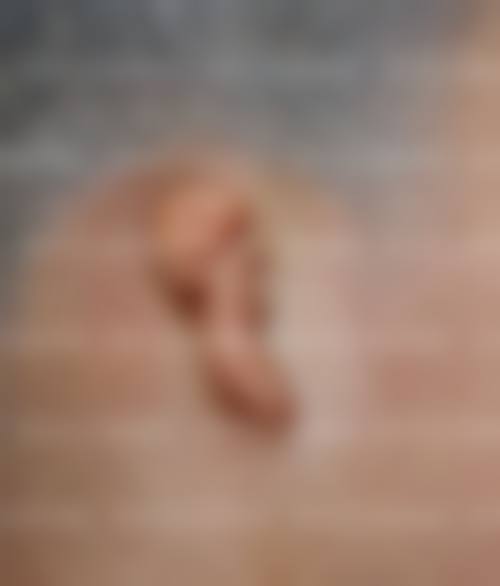 上海交通大学医学校附属仁济医院整形外科口碑好不好？附真实患者口碑评价