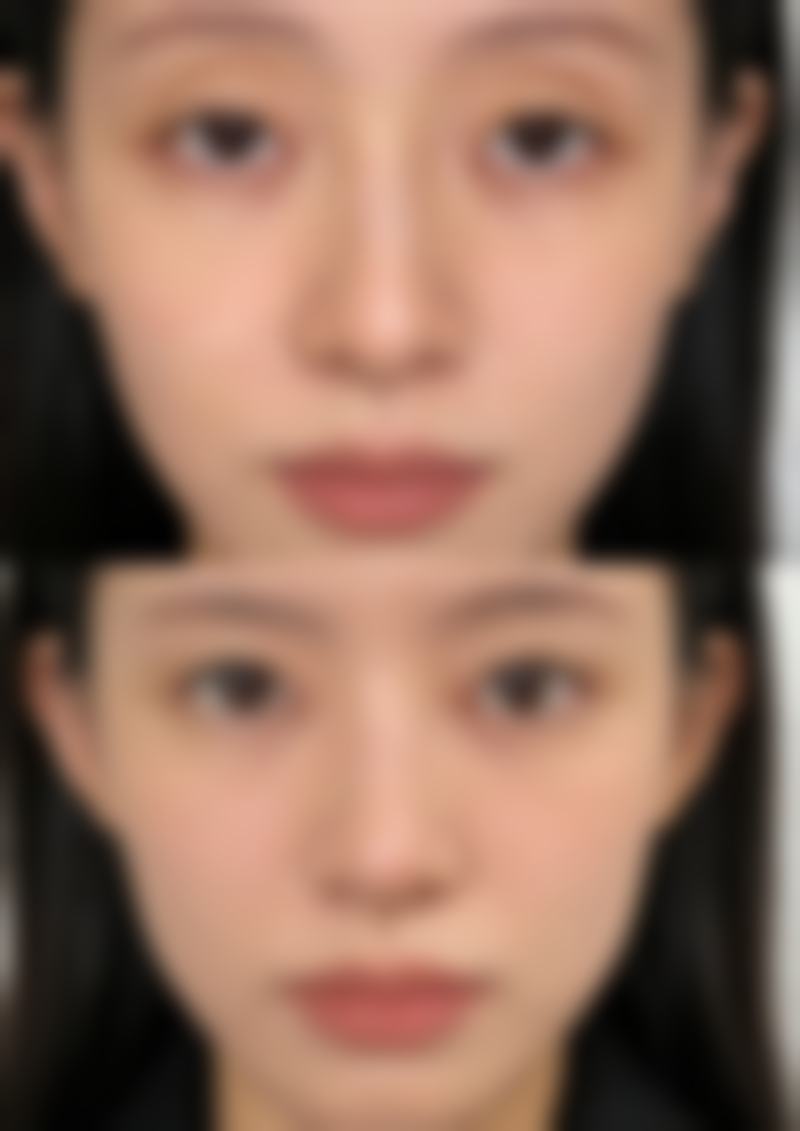 峨眉山世美医疗美容诊所更擅长什么手术