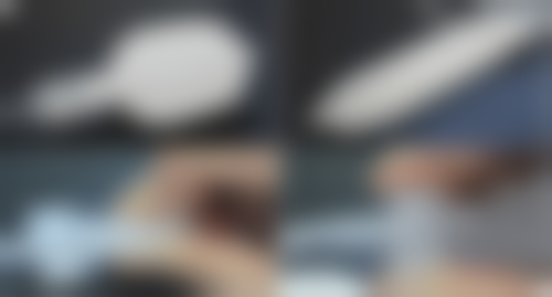 去完眼袋有皱纹,术后忌口要牢记