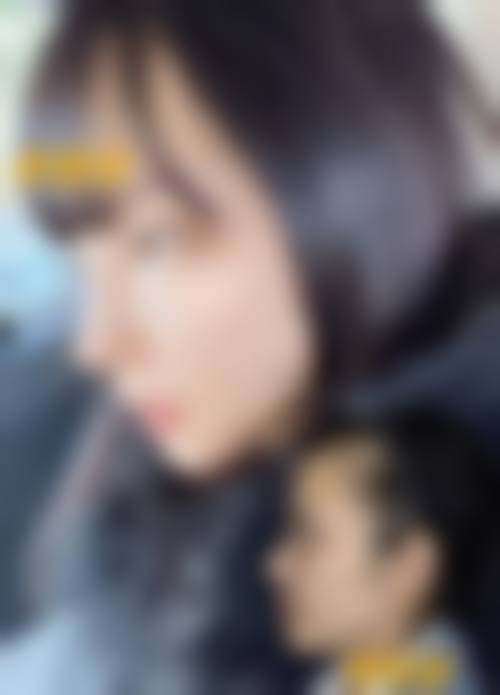 杭州悦可医疗美容诊所陈彩媛手术的专精性:国内外会员+学术交流=技术保护