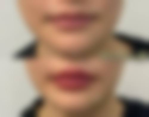 佛山市顺德区北滘医院整形美容科真实患者口碑评价