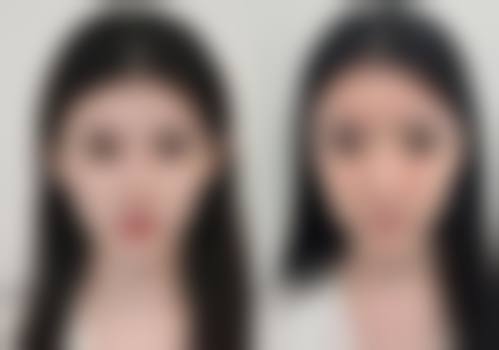 兴义市熊文学美容整形外科诊所更擅长什么手术