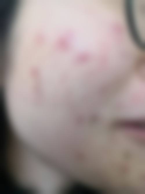 韩国slow整形外科医院价格表