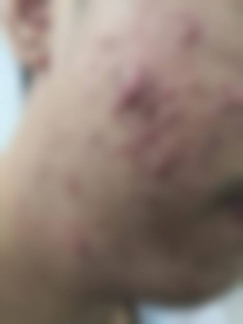 宁波白沙艺生美整形医院项目特色