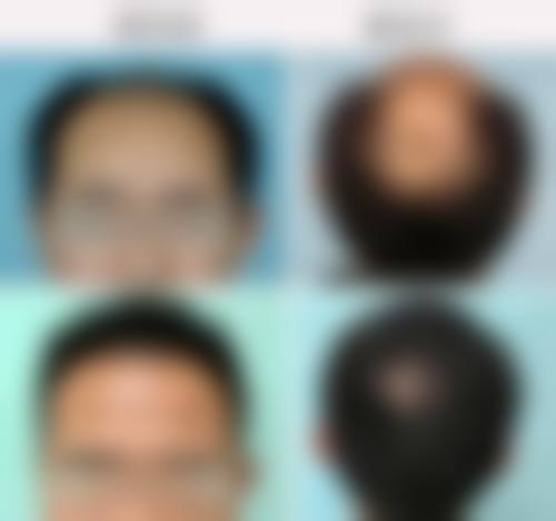 青岛金肤康皮肤病医院地址及乘车路线