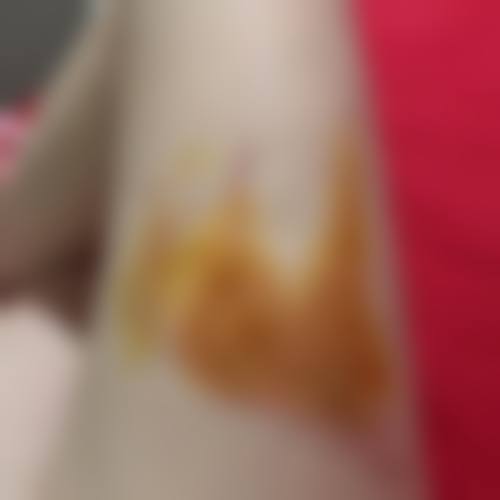 韩国slow整形外科医院项目特色