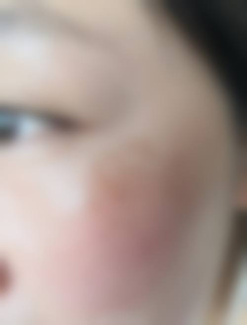 武汉杨宏医疗美容诊所怎么样？评价