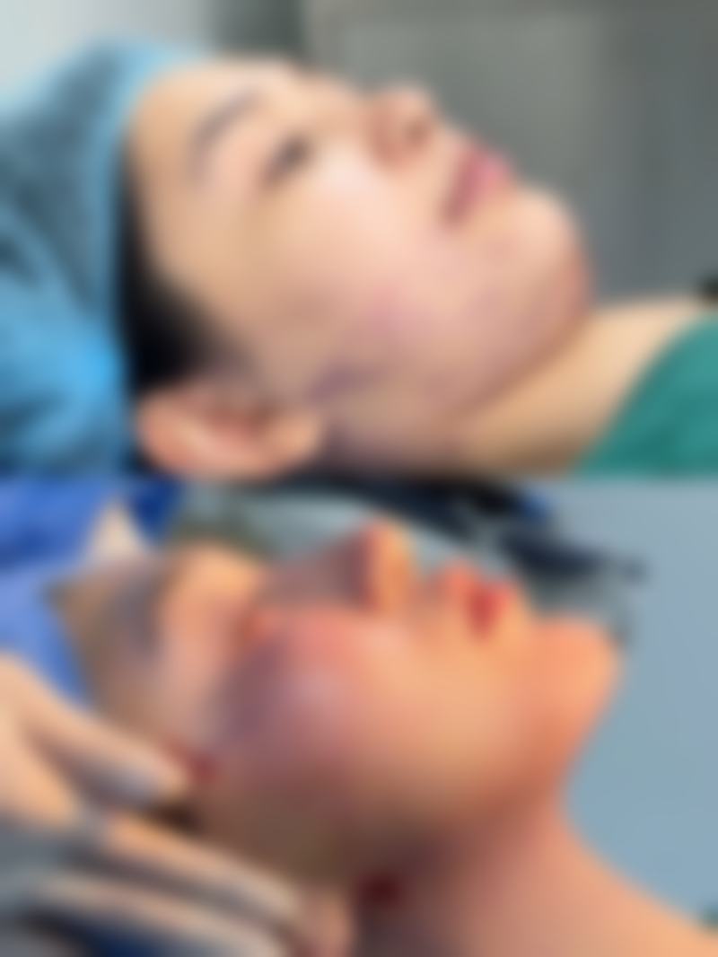 去完眼袋有皱纹,术后伤口清洁要重视