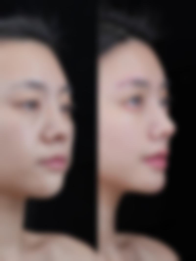 青岛颖逸整形医院怎么样，口碑评价如何？