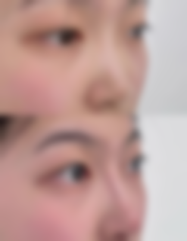 北京艺舍丽格医疗美容门诊部顾客实例