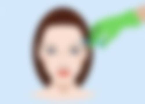 疤痕一直痒是怎么回事之医学专精治疗方案