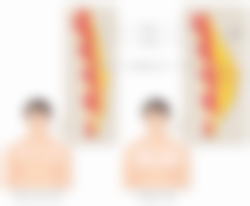 长期的下眼袋怎么去除——日常习惯要养成