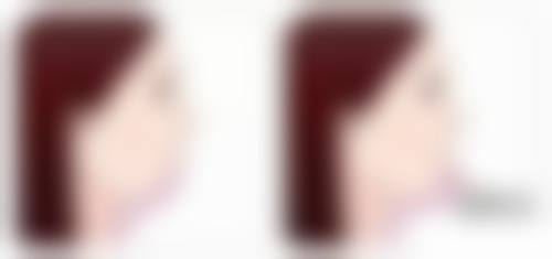 疤痕一直痒是怎么回事之不同类型疤痕瘙痒大揭秘