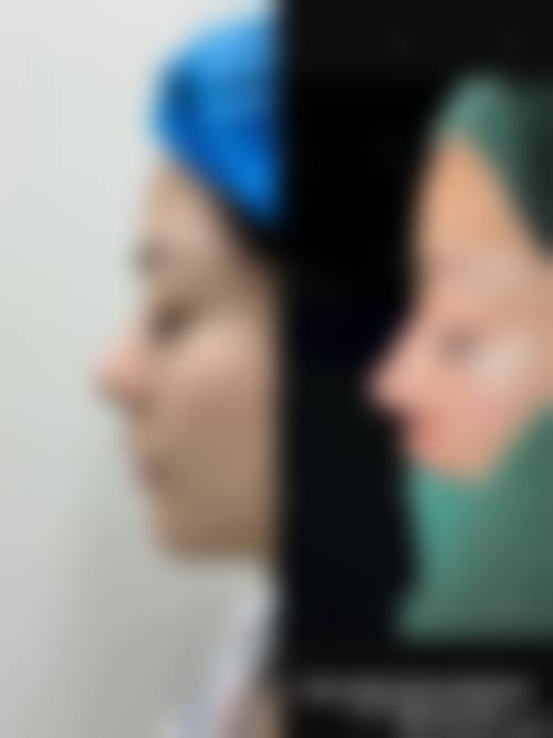 兴城伊丽家医疗美容诊所怎么样，怎么挂号，地址在哪儿