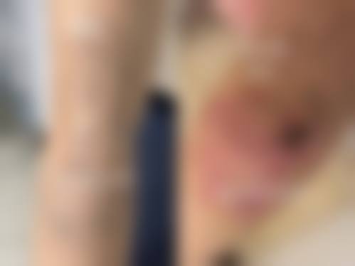 濮阳华美医疗美容诊所更擅长什么手术