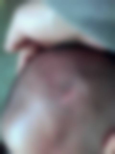 韩国G皮肤科怎么样？正规吗