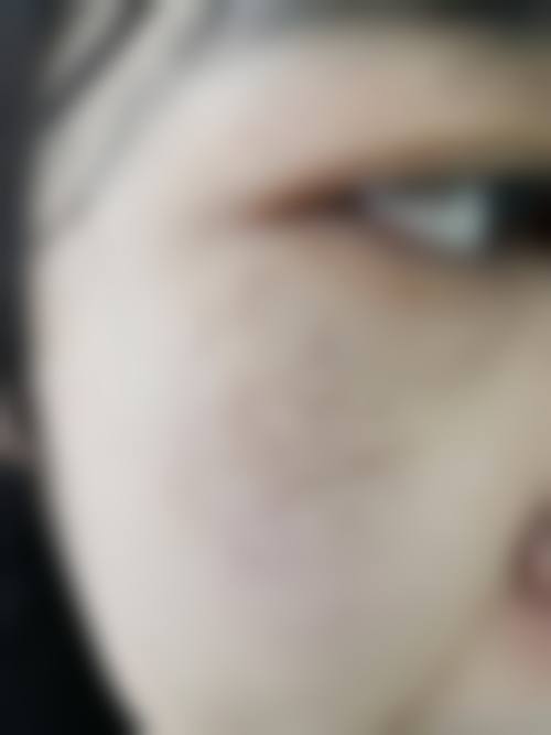 南宁美丽之星整形美容机构口碑好不好